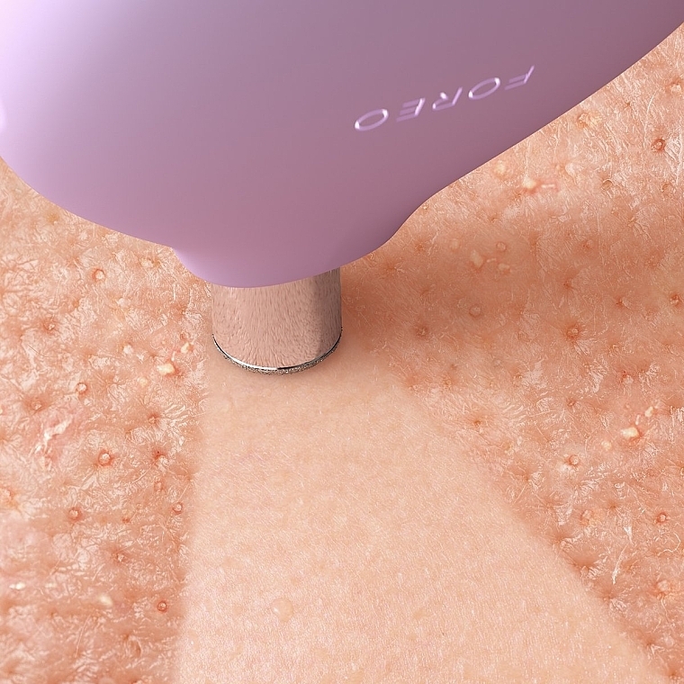 Gerät zur Mikrodermabrasion und Porenreinigung - Foreo Kiwi Derma Diamond Microdermabrasion & Pore Vacuum Device — Bild N4