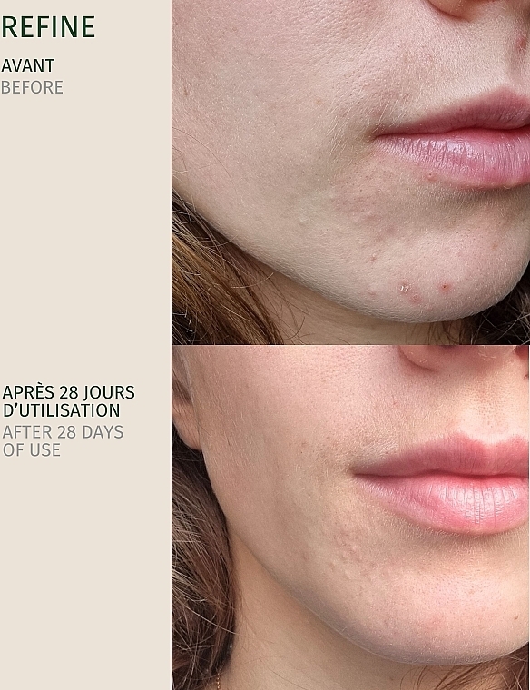 Perfektionierendes Gesichtsserum - Pureality Refine Skin Perfecting Serum — Bild N5