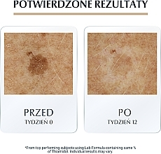 Anti-Aging Gesichtsserum mit Hyaluronsäure gegen Altersflecken für mehr Hautelastizität für reife Haut - Eucerin Hyaluron-Filler + Elasticity Anti-Age 3D Serum — Bild N7