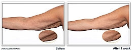 Straffende und glättende Creme für reife Haut - Roc Multi Correxion Crepe Repair Targeted Treatment — Bild N3