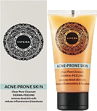 Gesichtspeeling für fettige und zu Akne neigende Haut - Vipera Cos-Medica Acne-Prone Skin Derma-Peeling — Bild N2