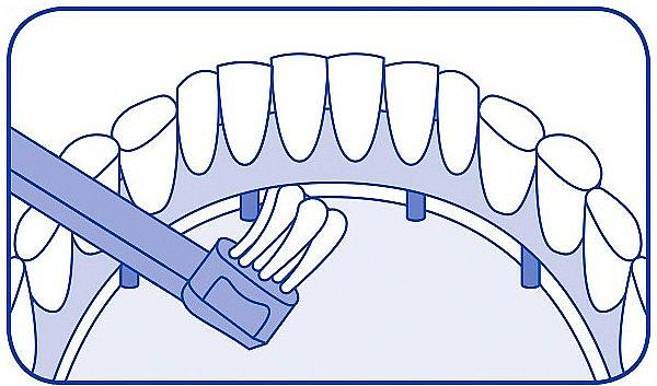 Einbüschelbürste CS 708 violett - Curaprox CS 708 Implant — Bild N5