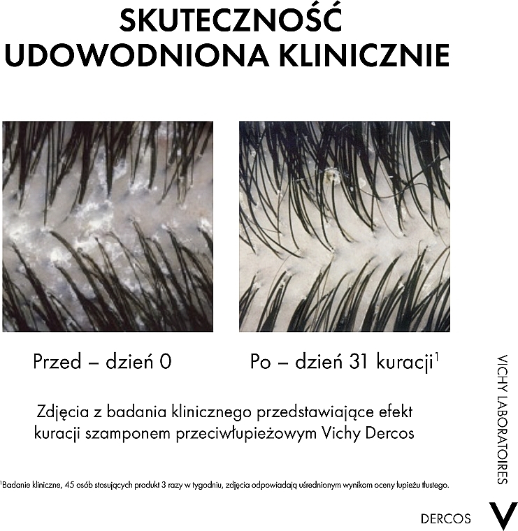 2in1 Anti-Schuppen Shampoo-Conditioner für alle Haartypen und gereizte Kopfhaut - Vichy Dercos 2in1 Shampoo  — Bild N2