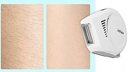 Laser-Epilierer weiß - Inface Ipl Hair Removal Ii Zh-01F White  — Bild N6