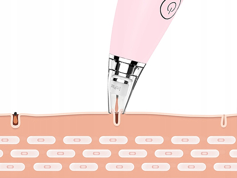 Elektrisches Vakuum-Gerät zur tiefen Gesichtsreinigung rosa - InFace MS7000 Pink — Bild N5