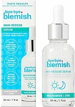 Düfte, Parfümerie und Kosmetik Gesichtsserum mit Niacinamid und Zink - Bye Bye Blemish Skin Rescue Niacinamide Serum