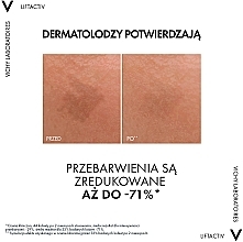 Anti-Aging Gesichtsserum gegen Pigmentflecken und Falten mit Niacinamid und Glykolsäure - Vichy Liftactiv Specialist B3 Serum — Bild N5