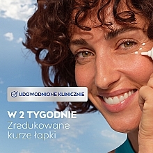 Augencreme - Nivea Q10 Plus Anti-wrinkle Eye Care — Bild N5