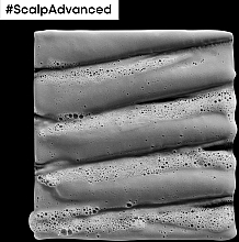 Tiefenreinigende Tonerde für das Haar - L'Oreal Professionnel Scalp Advanced Anti-Oiliness 2 In 1 Deep Purifier Clay — Bild N6