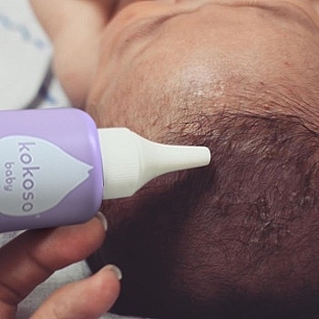 Heilmittel für seborrhoische Krusten - Kokoso Baby Skincare Happy Scalp Cream — Bild N10