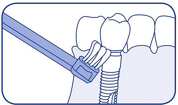 Einbüschelbürste CS 708 violett - Curaprox CS 708 Implant — Bild N4