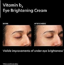 Aufhellende Augencreme - PCA Skin Vitamin B3 Eye Brightening Cream — Bild N3