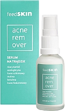 Gesichtsserum gegen Akne - Feedskin Acne Remover Serum — Bild N2